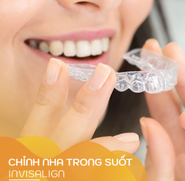 Chỉnh nha trong suốt Invisalign