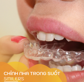 Chỉnh nha trong suốt Smilers