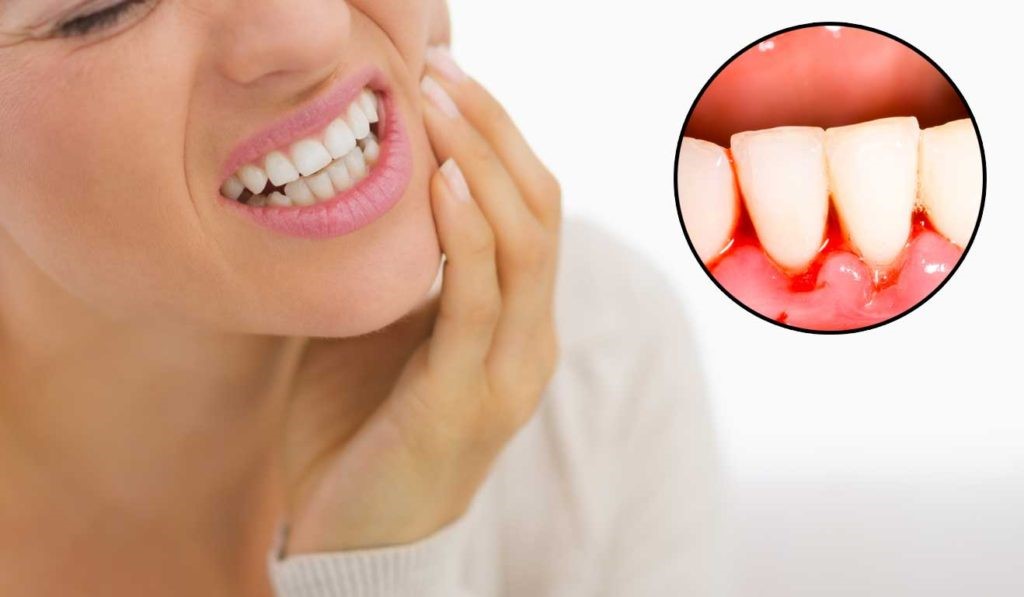 Nguyên nhân gây chảy máu chân răng | Nha khoa Tâm Như - Quận 10