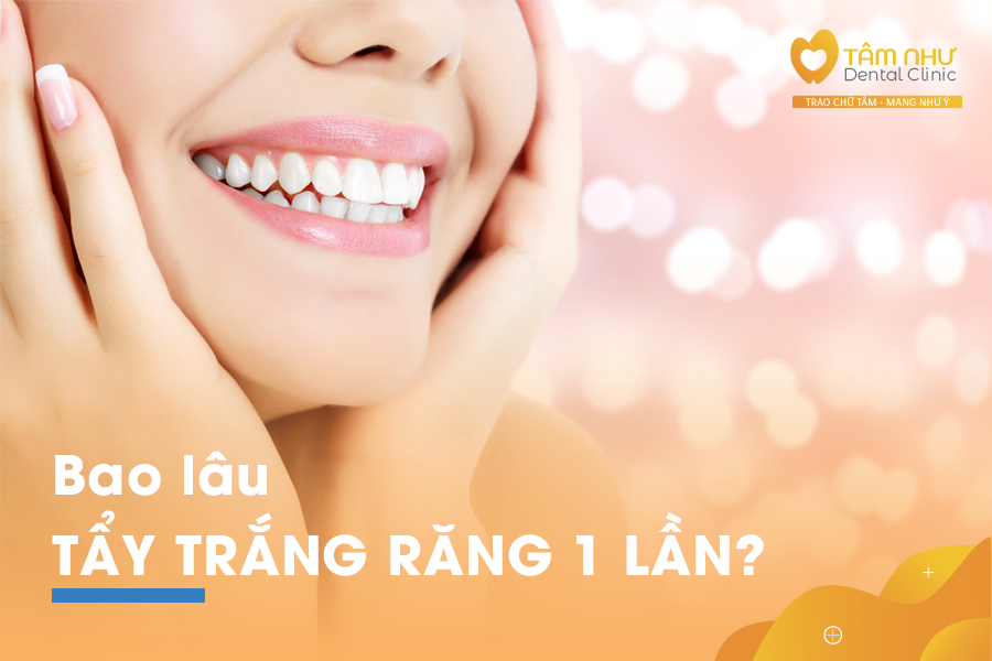 Bao lâu tẩy trắng răng một lần là tốt nhất? | Nha khoa Tâm Như - Quận 10