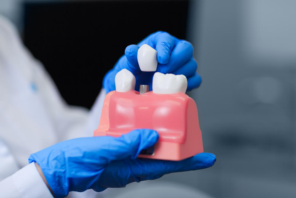 Cấy ghép Implant phương pháp thay thế răng bị mất tốt nhất | nha khoa Tâm Như - Quận 10