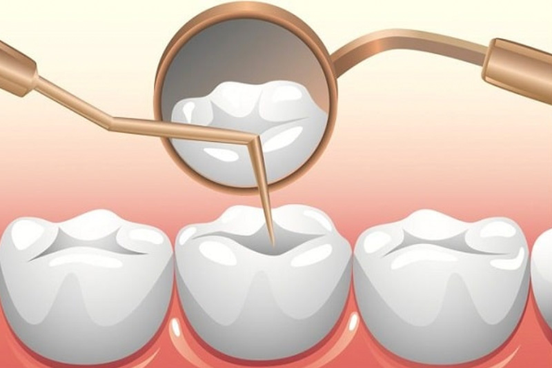 điều trị tủy răng | nha khoa Tâm Như - Quận 10