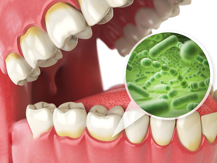 nguyên nhân gây hại men răng | nha khoa Tâm Như - Quận 10