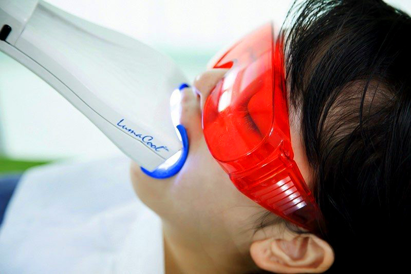 Làm trắng răng tại nha khoa Tâm Như với hệ thống LumaCool