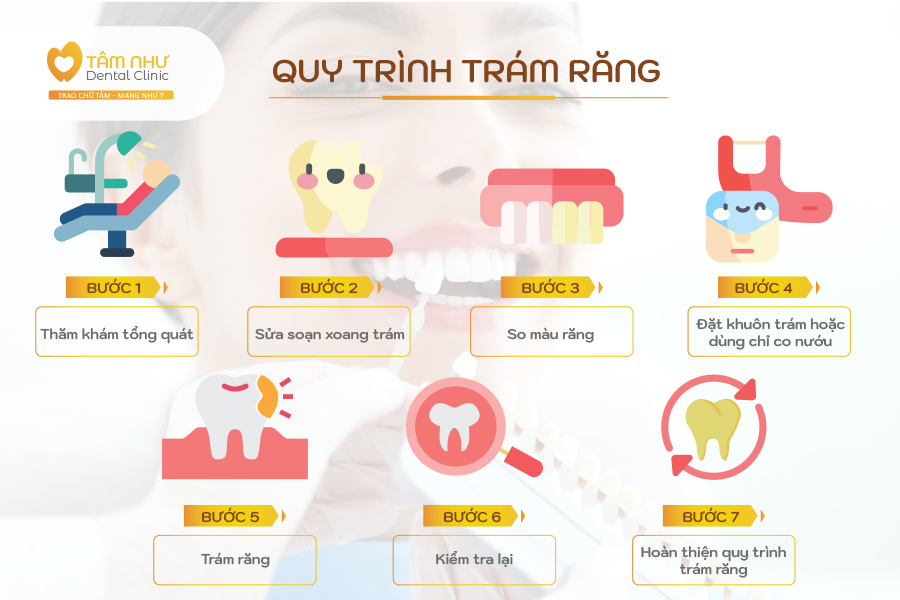 Quy trình trám răng thẩm mỹ hiệu quả và an toàn tại Nha khoa Tâm Như